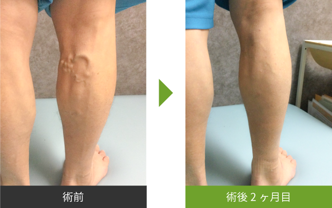 ビフォーアフター